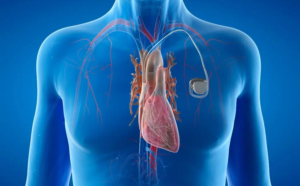 Kieszonkowe EKG dla osób aktywnych – jak monitorować serce w ruchu